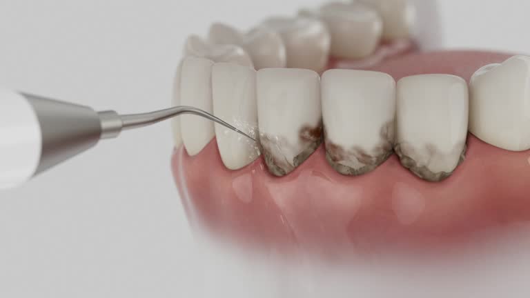 Trusted Dental Crowns And Bridges service in DeRidder, LA - Dentist Open Now